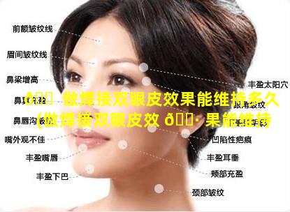 🐠 做焊接双眼皮效果能维持多久(做焊接双眼皮效 🌷 果能维持多久呢)